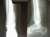 coimbatore-orthopaedic-joint-replacement-maternity-child-welfare-centre-india